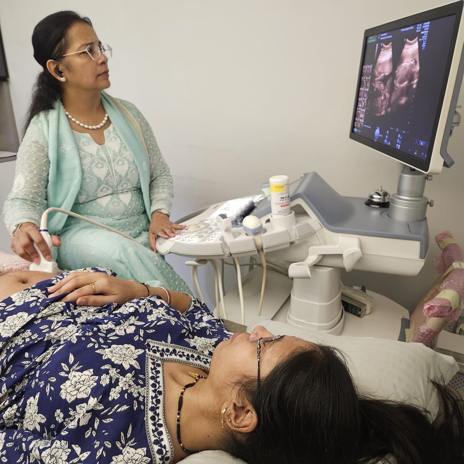 Gemini ultrasound equipment